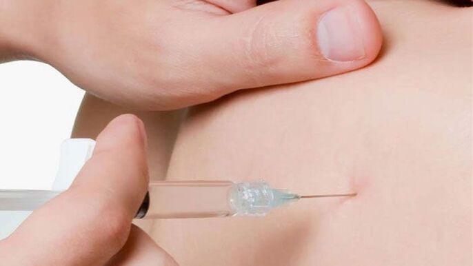 farmacopuntura per osteocondrosi mammariarosi