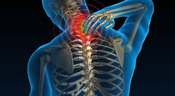Osteocondrite della colonna vertebrale
