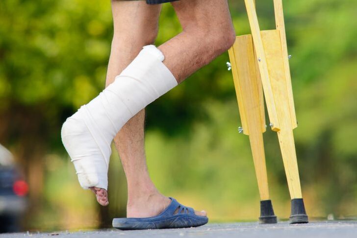 lesione alla caviglia come causa di artrosi